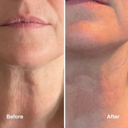 Skin Rejuvenating LED face & neck mask