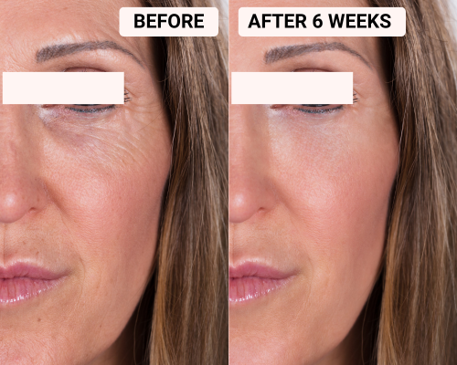 Skin Rejuvenating LED face & neck mask