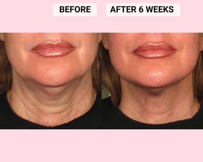 Skin Rejuvenating LED face & neck mask