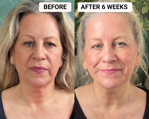 Skin Rejuvenating LED face & neck mask